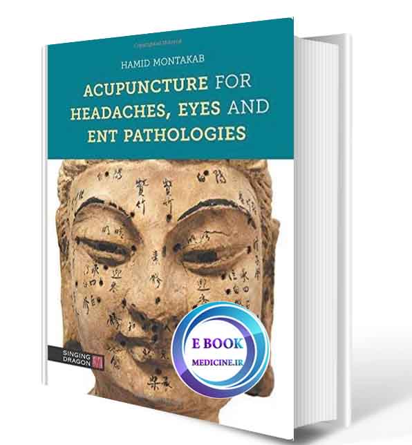 دانلود کتاب Acupuncture for Headaches, Eyes and ENT Pathologies 2018(ORIGINAL PDF)